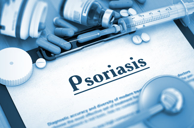 Perspective on Psoriasis
